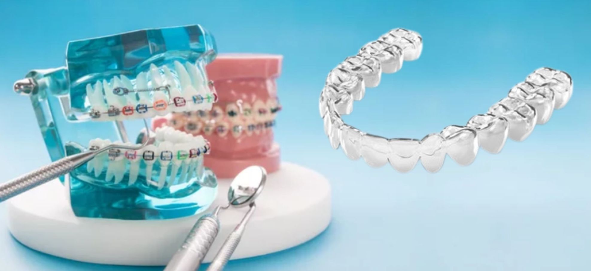 aligners-braces-1